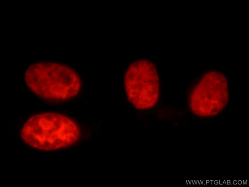 [16389-1-AP-150UL] XRCC5/Ku80 Polyclonal antibody