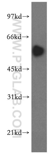 [16397-1-AP-150UL] SMAD9 Polyclonal antibody