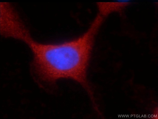 [16400-1-AP-150UL] UBQLNL Polyclonal antibody