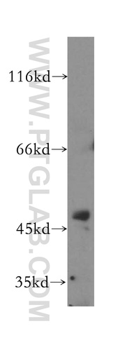 [16436-1-AP-20UL] FARS2 Polyclonal antibody