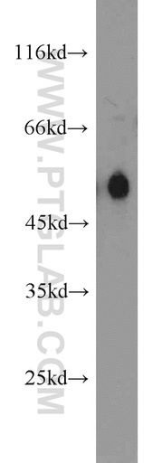 [16440-1-AP-150UL] Carboxypeptidase M Polyclonal antibody