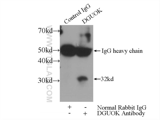 [16459-1-AP-150UL] dGK Polyclonal antibody