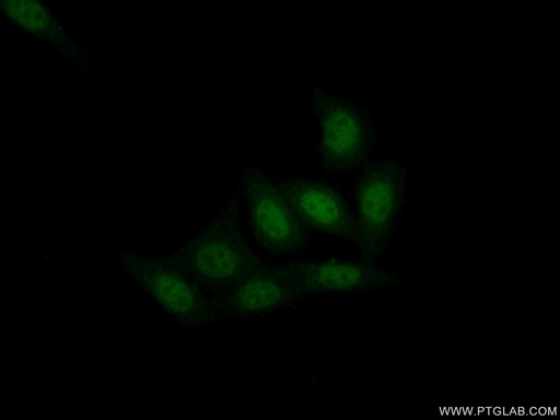 [16462-1-AP-20UL] XPA Polyclonal antibody