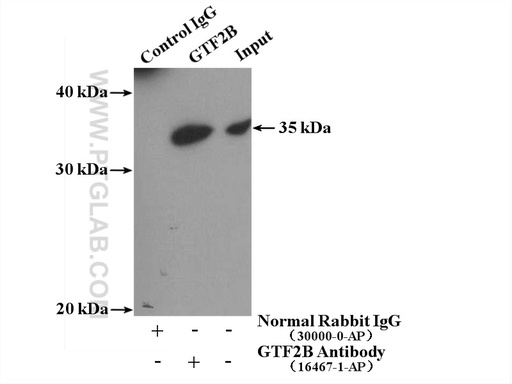[16467-1-AP-20UL] GTF2B Polyclonal antibody