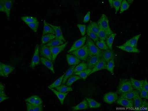 [16471-1-AP-20UL] SRI Polyclonal antibody