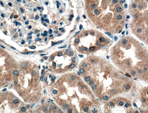 [16474-1-AP-20UL] ADH4 Polyclonal antibody