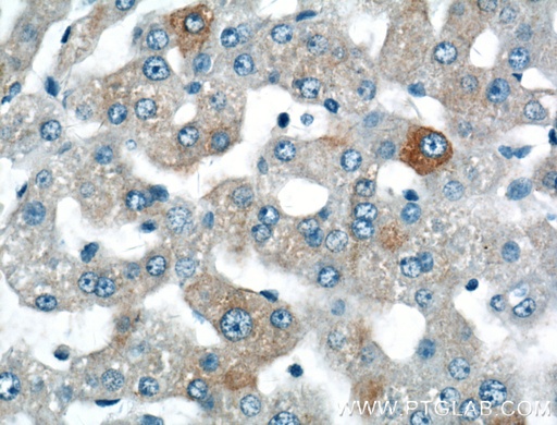 [16555-1-AP-150UL] SPG11 Polyclonal antibody