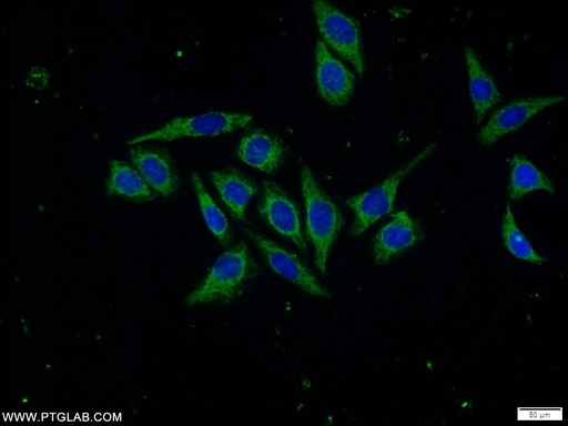 [16558-1-AP-20UL] Napsin A Polyclonal antibody