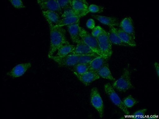 [16567-1-AP-150UL] FUT6 Polyclonal antibody