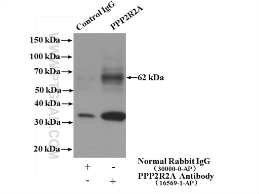 [16569-1-AP-150UL] PPP2R2A Polyclonal antibody