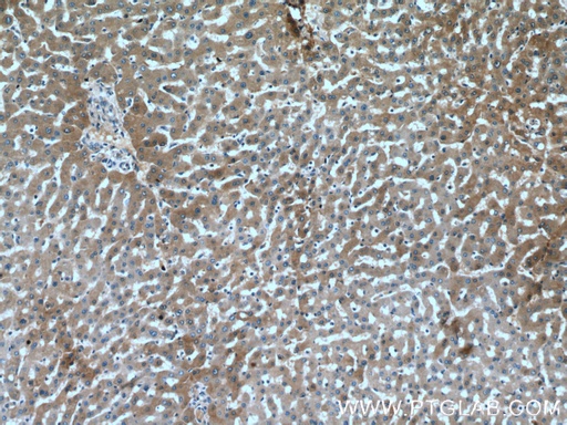 [16571-1-AP-20UL] Fetuin-A Polyclonal antibody