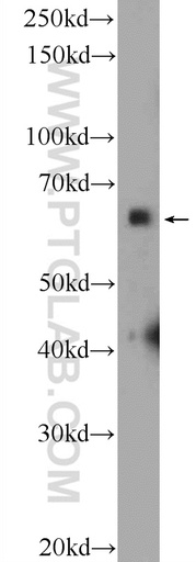 [16573-1-AP-150UL] SYN2 Polyclonal antibody