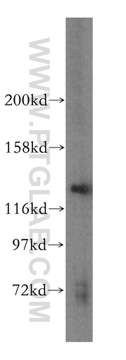 [16574-1-AP-150UL] POLR3B Polyclonal antibody