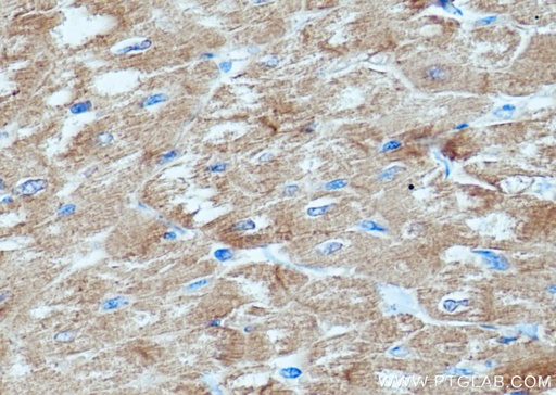 [16582-1-AP-20UL] AGL Polyclonal antibody