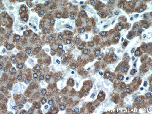 [16583-1-AP-150UL] CFHR3 Polyclonal antibody