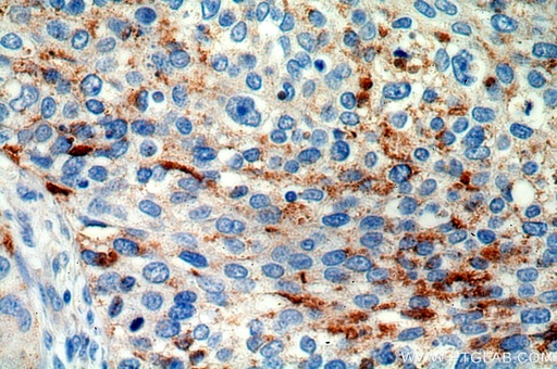 [16584-1-AP-20UL] MRPL3 Polyclonal antibody