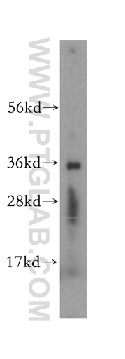 [16585-1-AP-150UL] SDR39U1 Polyclonal antibody