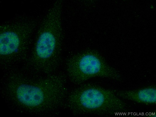 [16590-1-AP-150UL] MED31 Polyclonal antibody