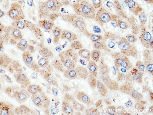 [16591-1-AP-20UL] ACSM5 Polyclonal antibody