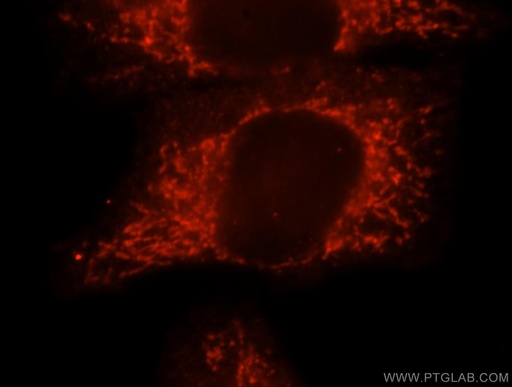 [16593-1-AP-20UL] IMPA1 Polyclonal antibody