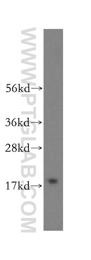 [16595-1-AP-20UL] ZNHIT1 Polyclonal antibody