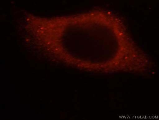 [16597-1-AP-20UL] SMAP2 Polyclonal antibody
