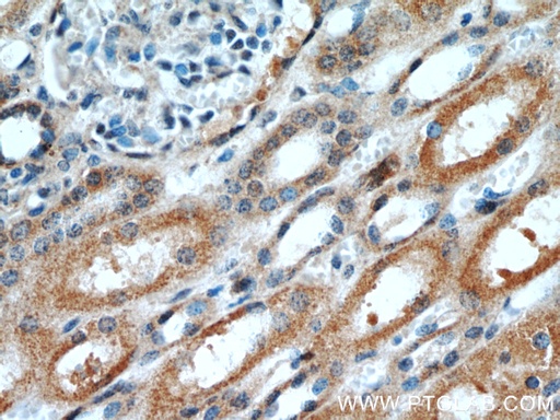 [16605-1-AP-20UL] OTUD7B Polyclonal antibody