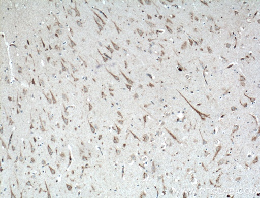 [16606-1-AP-20UL] KCNMB2 Polyclonal antibody