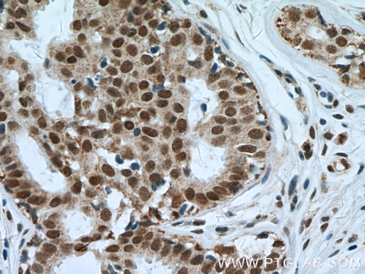 [16607-1-AP-150UL] NuMA Polyclonal antibody