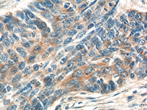 [16610-1-AP-150UL] ATAD3A/B Polyclonal antibody