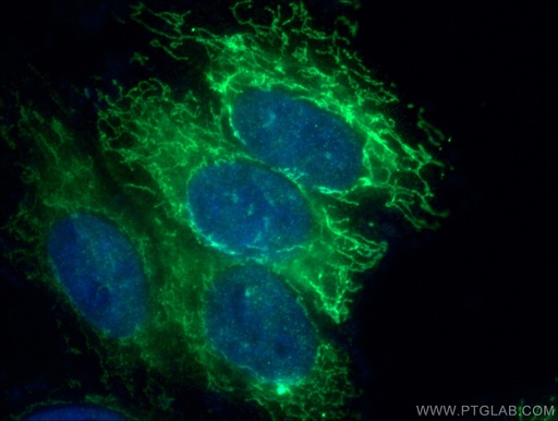 [16611-1-AP-20UL] MRPL46 Polyclonal antibody