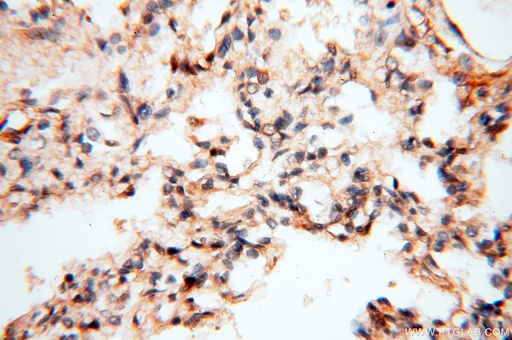 [16613-1-AP-150UL] PITPNA Polyclonal antibody