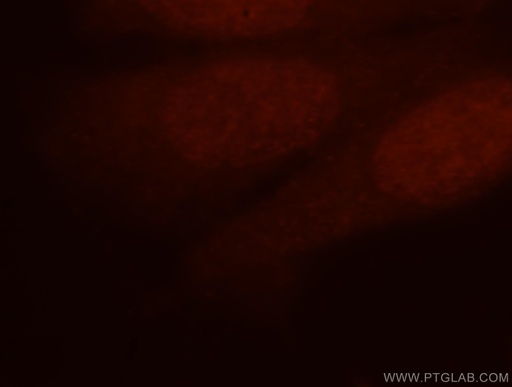 [16615-1-AP-20UL] CDKN2AIP Polyclonal antibody