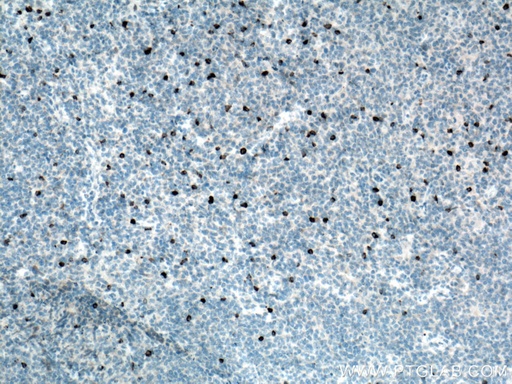 [16616-1-AP-20UL] LAG-3 Polyclonal antibody