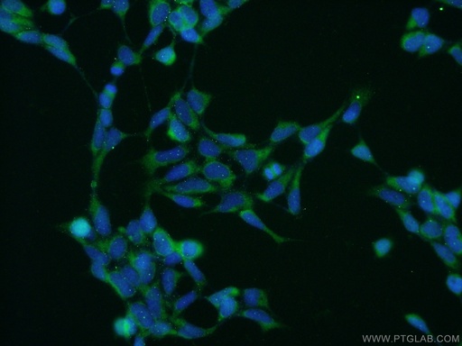 [16617-1-AP-150UL] CAD Polyclonal antibody