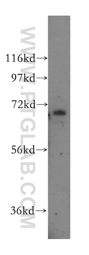 [16618-1-AP-20UL] ZNF143 Polyclonal antibody