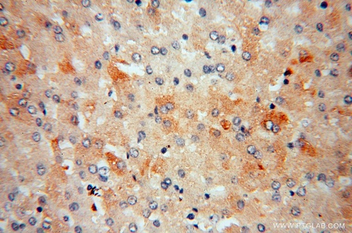[16619-1-AP-150UL] ME1 Polyclonal antibody