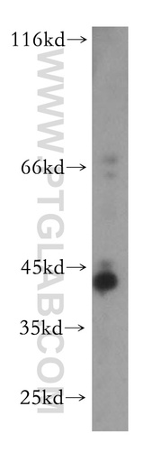 [16621-1-AP-20UL] TMLHE Polyclonal antibody
