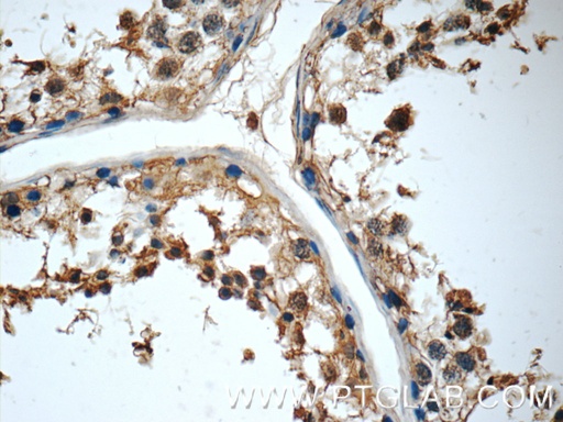 [16625-1-AP-150UL] MRPL36 Polyclonal antibody