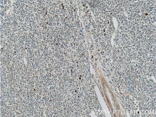 [16630-1-AP-150UL] S100A12 Polyclonal antibody