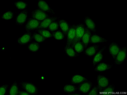 [16632-1-AP-20UL] HDDC2 Polyclonal antibody