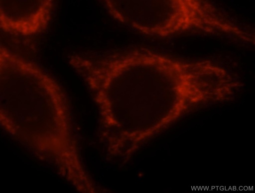 [16634-1-AP-150UL] OCIAD1 Polyclonal antibody