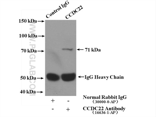 [16636-1-AP-150UL] CCDC22 Polyclonal antibody