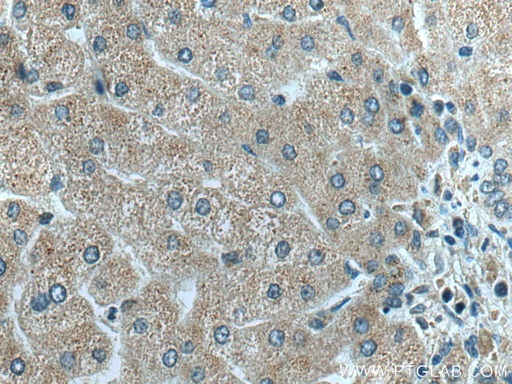 [16641-1-AP-150UL] C18orf55 Polyclonal antibody