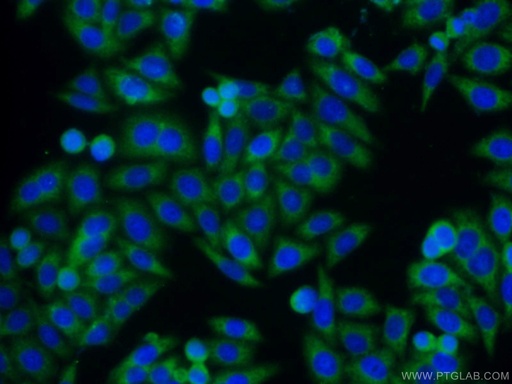 [16644-1-AP-20UL] TIMP1 Polyclonal antibody