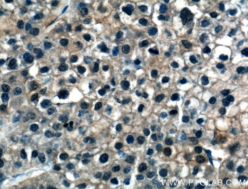 [16645-1-AP-20UL] ASL Polyclonal antibody