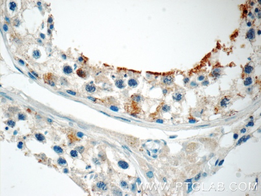 [16647-1-AP-20UL] ZER1 Polyclonal antibody