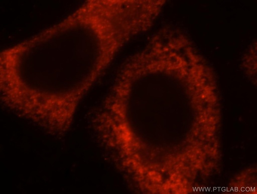 [16649-1-AP-20UL] RPL28 Polyclonal antibody