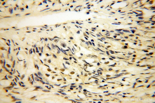 [16650-1-AP-20UL] LDB1 Polyclonal antibody