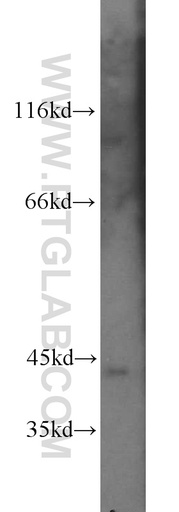 [16651-1-AP-20UL] PRKX Polyclonal antibody